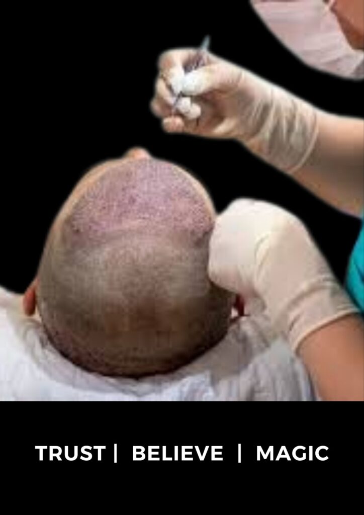 Hair restorations